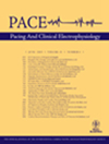 Pace-pacing And Clinical Electrophysiology雜志